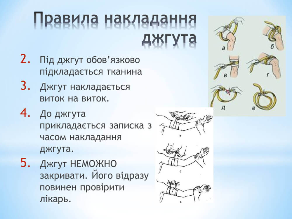 Правила накладання джгута