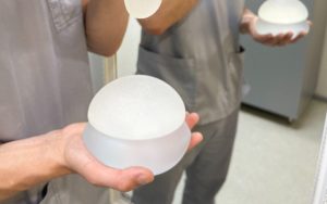 Заміна імплантів